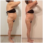 50代からの痩身 スタイル褒められ体験✨