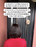 ご来店まで迷っていた50代のお客様